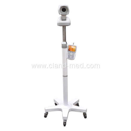 Good Price Handheld Video Vagina Colposcope With Tripod